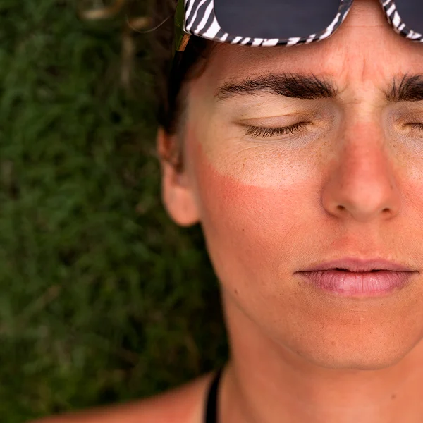 Une femme portant des lunettes de soleil, affichant un teint terne.