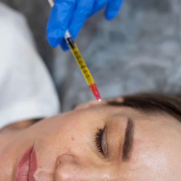 Un homme reçoit une injection de plasma dans le visage pour des soins esthétiques.