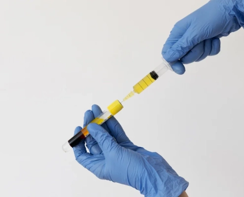 Une personne en gants bleus tient un tube de liquide jaune, potentiellement pour une injection de plasma facial.