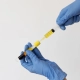 Une personne en gants bleus tient un tube de liquide jaune, potentiellement pour une injection de plasma facial.