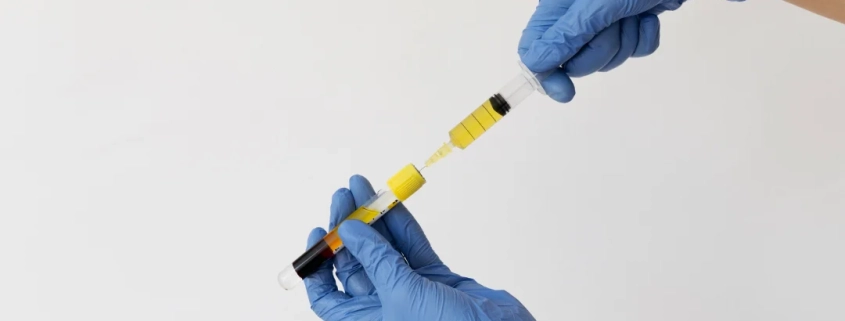 Une personne en gants bleus tient un tube de liquide jaune, potentiellement pour une injection de plasma facial.